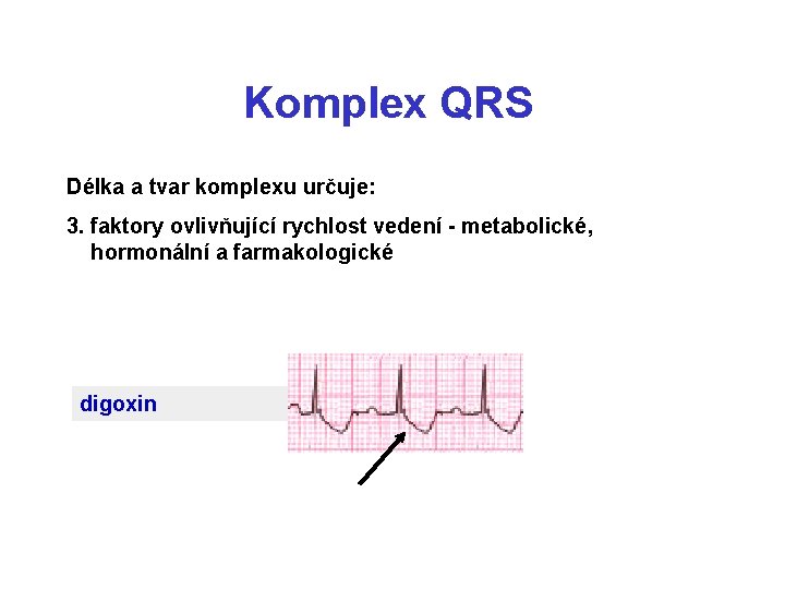 Komplex QRS Délka a tvar komplexu určuje: 3. faktory ovlivňující rychlost vedení - metabolické,