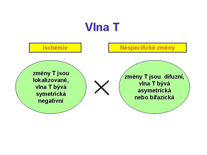 Vlna T Ischemie změny T jsou lokalizované, vlna T bývá symetrická negativní Nespecifické změny