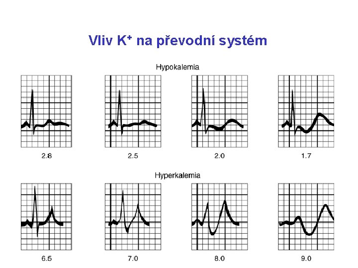 Vliv K+ na převodní systém 