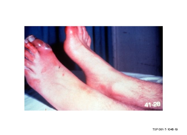 TSP 081 -T-1045 -19 TSP 081 -T-1045 -19