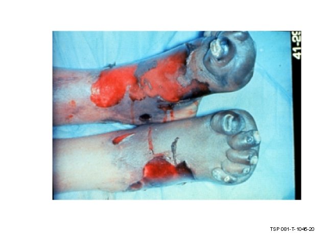 TSP 081 -T-1045 -20 TSP 081 -T-1045 -20