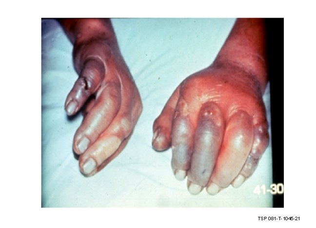 TSP 081 -T-1045 -21 TSP 081 -T-1045 -21