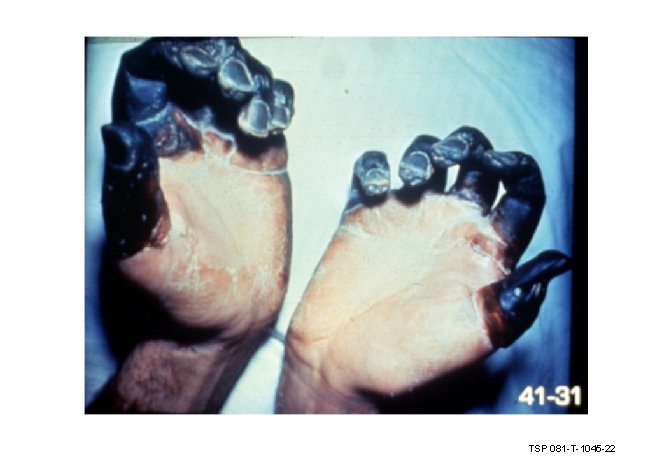 TSP 081 -T-1045 -22 TSP 081 -T-1045 -22