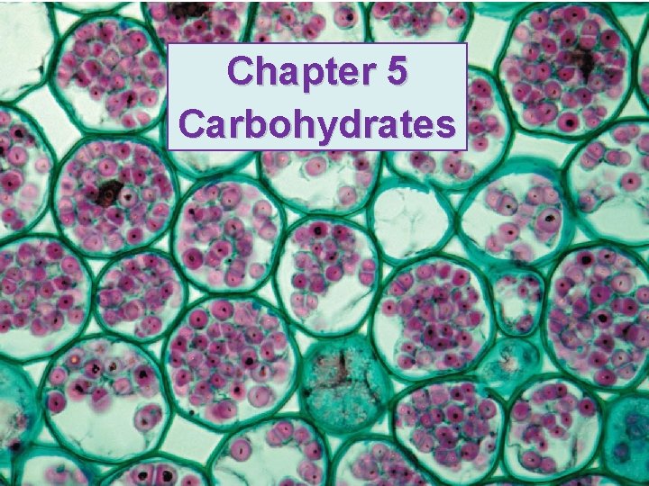 Chapter 5 Carbohydrates 