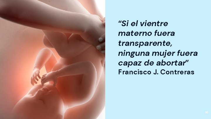 “Si el vientre materno fuera transparente, ninguna mujer fuera capaz de abortar” Francisco J.