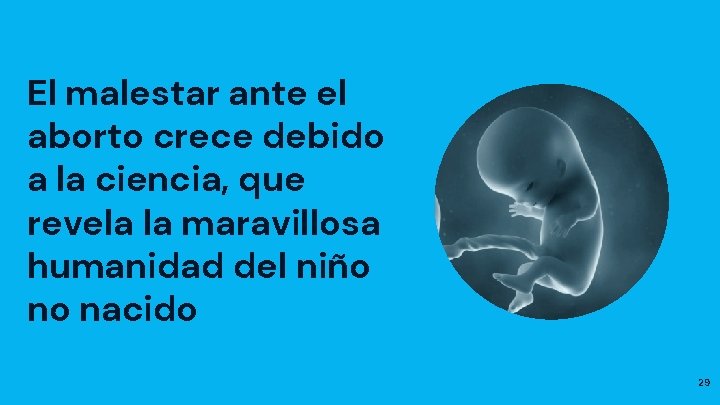El malestar ante el aborto crece debido a la ciencia, que revela la maravillosa
