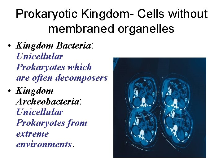 Prokaryotic Kingdom- Cells without membraned organelles • Kingdom Bacteria: Unicellular Prokaryotes which are often