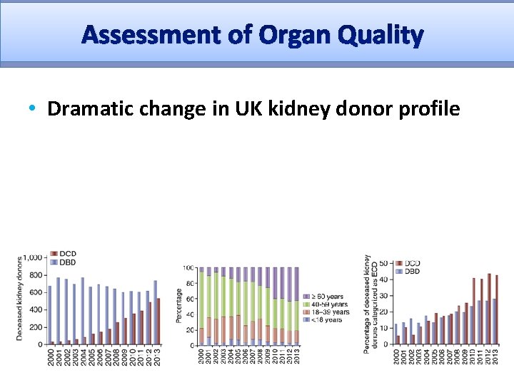 Assessment of Organ Quality • Dramatic change in UK kidney donor profile 