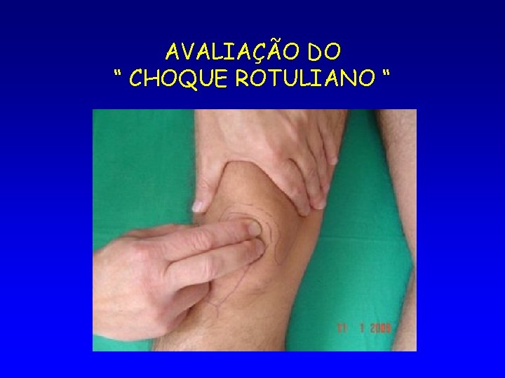 AVALIAÇÃO DO “ CHOQUE ROTULIANO “ 