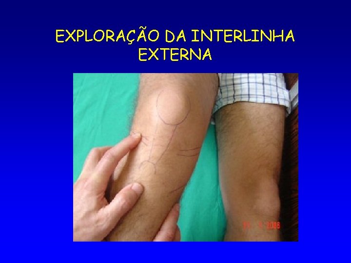 EXPLORAÇÃO DA INTERLINHA EXTERNA 