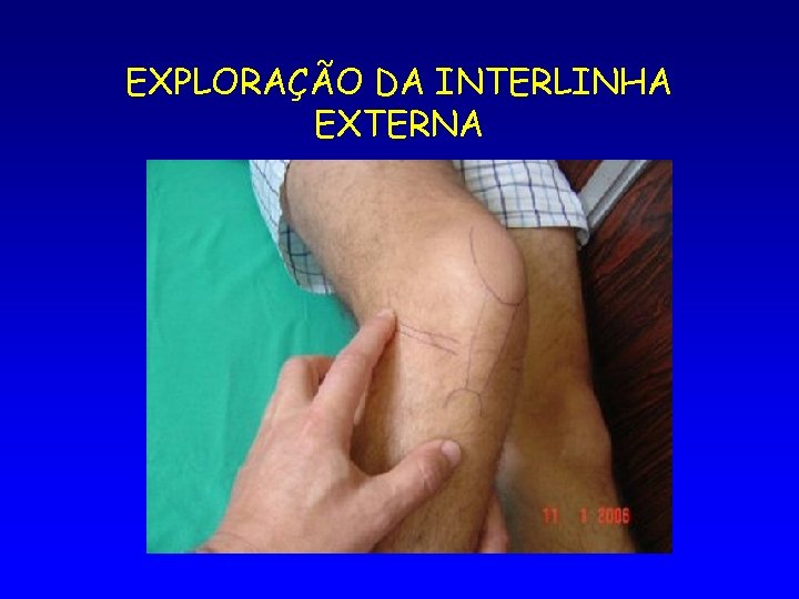 EXPLORAÇÃO DA INTERLINHA EXTERNA 