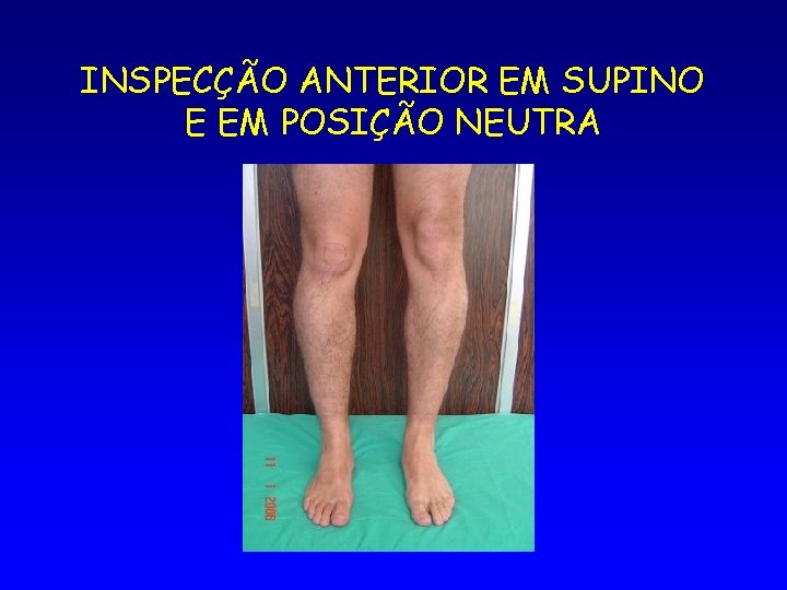 INSPECÇÃO ANTERIOR EM SUPINO E EM POSIÇÃO NEUTRA 