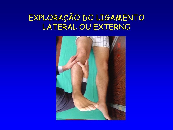 EXPLORAÇÃO DO LIGAMENTO LATERAL OU EXTERNO 