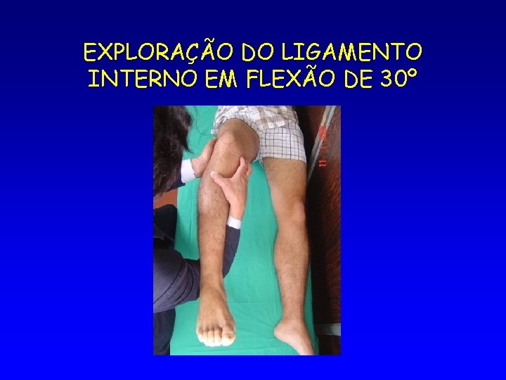 EXPLORAÇÃO DO LIGAMENTO INTERNO EM FLEXÃO DE 30º 