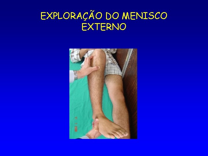 EXPLORAÇÃO DO MENISCO EXTERNO 