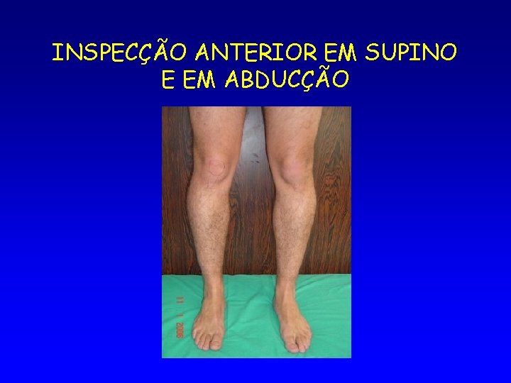 INSPECÇÃO ANTERIOR EM SUPINO E EM ABDUCÇÃO 