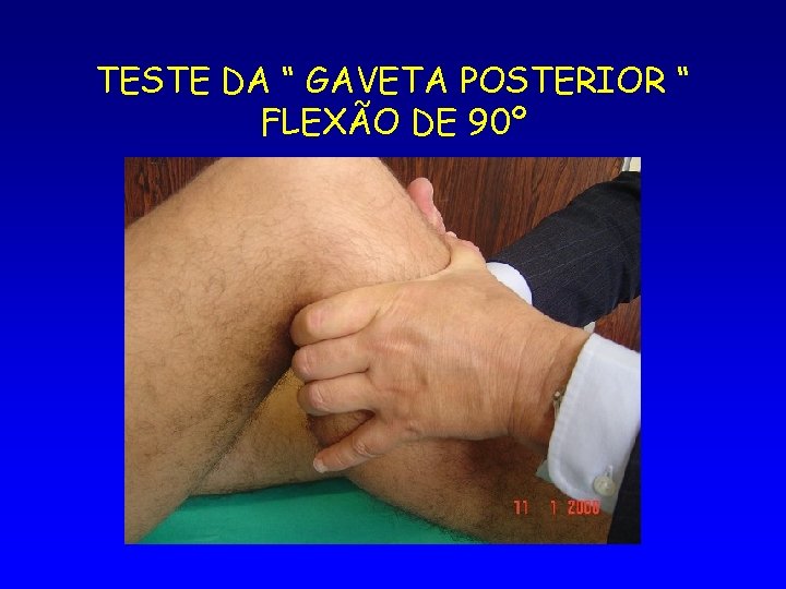 TESTE DA “ GAVETA POSTERIOR “ FLEXÃO DE 90º 