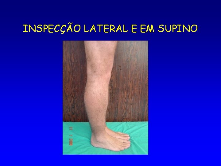 INSPECÇÃO LATERAL E EM SUPINO 