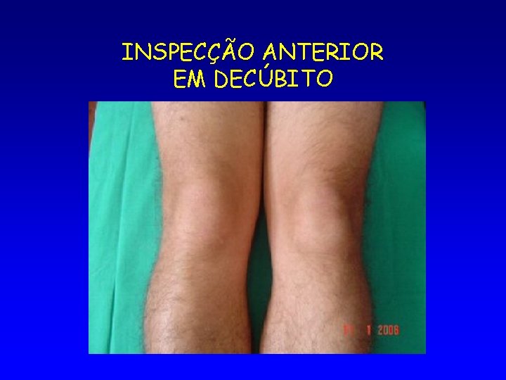 INSPECÇÃO ANTERIOR EM DECÚBITO 