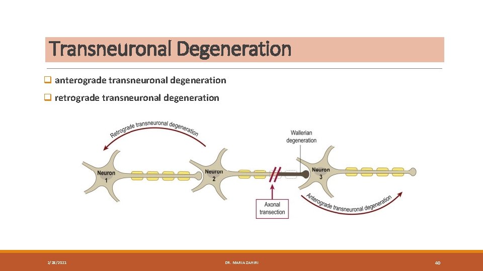 Transneuronal Degeneration q anterograde transneuronal degeneration q retrograde transneuronal degeneration 2/28/2021 DR. MARIA ZAHIRI