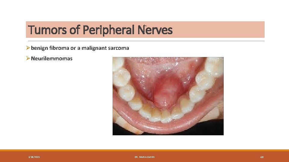 Tumors of Peripheral Nerves Øbenign fibroma or a malignant sarcoma ØNeurilemmomas 2/28/2021 DR. MARIA