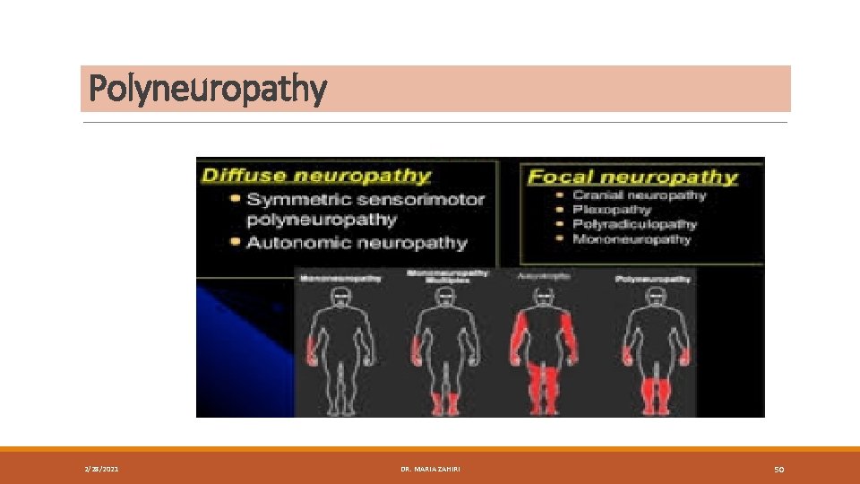 Polyneuropathy 2/28/2021 DR. MARIA ZAHIRI 50 
