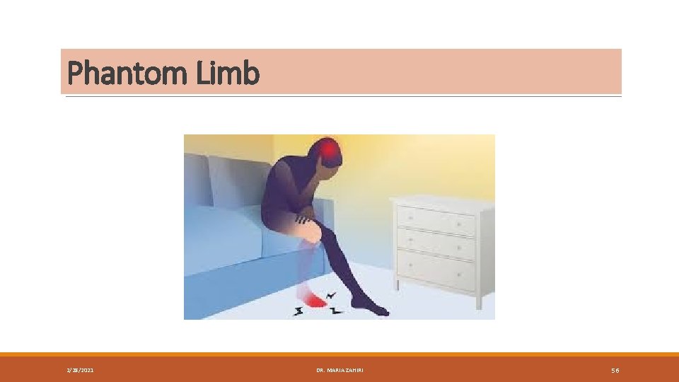 Phantom Limb 2/28/2021 DR. MARIA ZAHIRI 56 