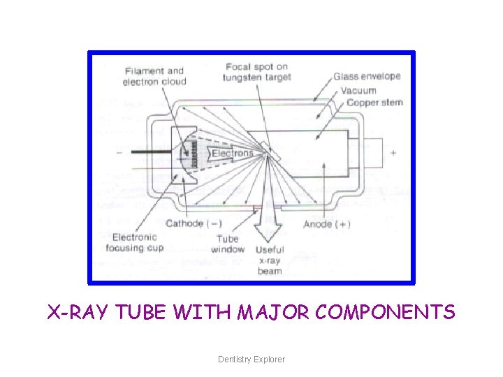 X-RAY TUBE WITH MAJOR COMPONENTS Dentistry Explorer 