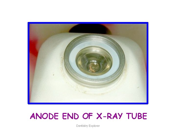 ANODE END OF X-RAY TUBE Dentistry Explorer 