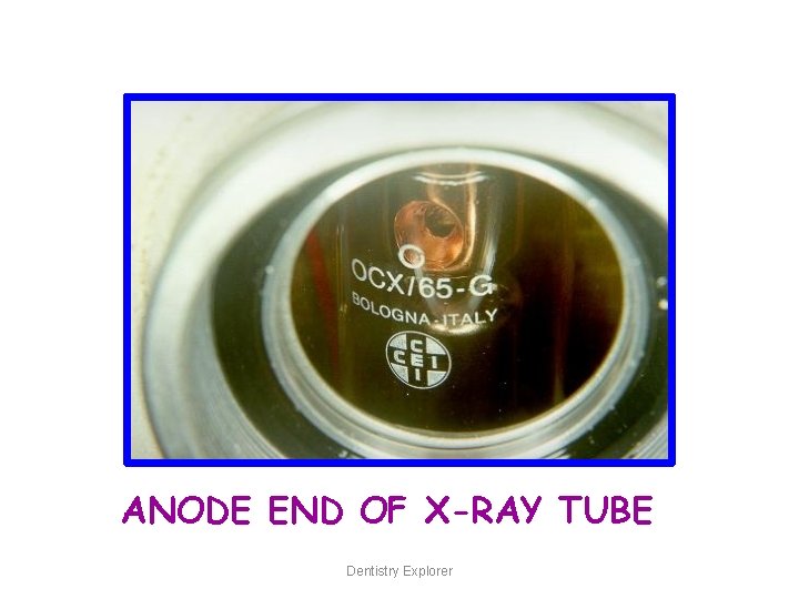 ANODE END OF X-RAY TUBE Dentistry Explorer 