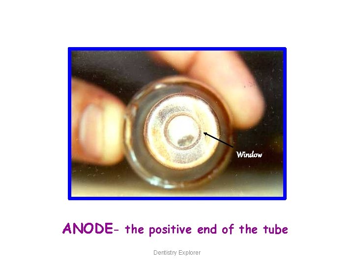 Window ANODE- the positive end of the tube Dentistry Explorer 