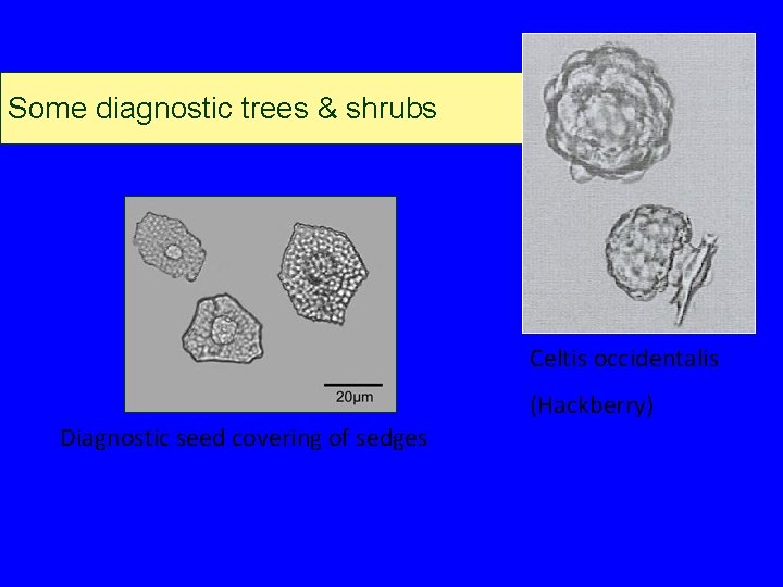 Some diagnostic trees & shrubs Celtis occidentalis (Hackberry) Diagnostic seed covering of sedges Some diagnostic trees & shrubs Celtis occidentalis (Hackberry) Diagnostic seed covering of sedges