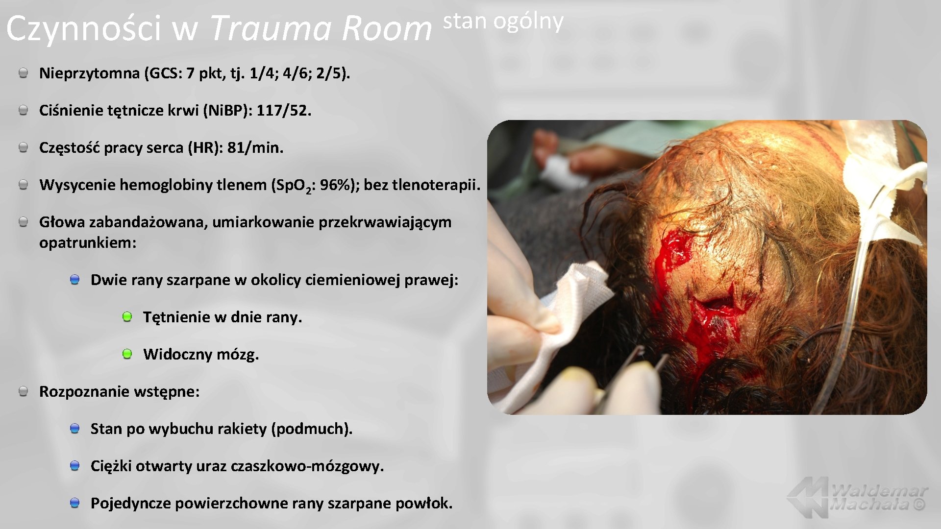 Czynności w Trauma Room stan ogólny Nieprzytomna (GCS: 7 pkt, tj. 1/4; 4/6; 2/5).