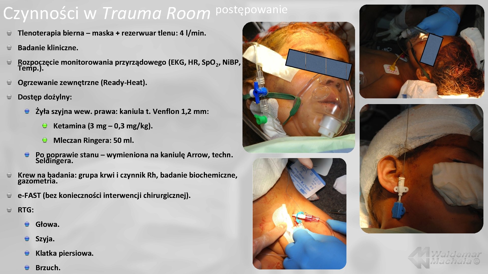 Czynności w Trauma Room postępowanie Tlenoterapia bierna – maska + rezerwuar tlenu: 4 l/min.