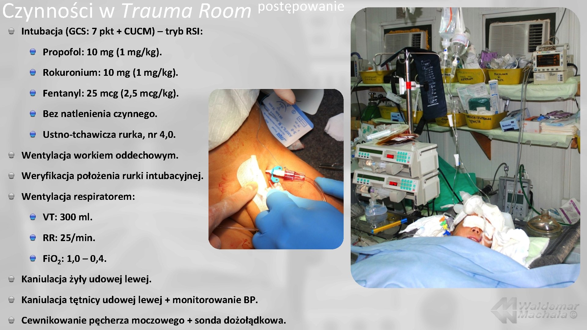 Czynności w Trauma Room postępowanie Intubacja (GCS: 7 pkt + CUCM) – tryb RSI: