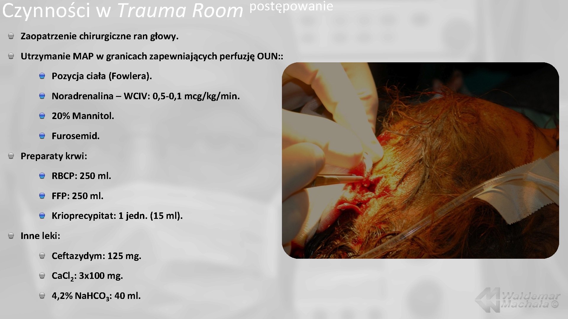 Czynności w Trauma Room postępowanie Zaopatrzenie chirurgiczne ran głowy. Utrzymanie MAP w granicach zapewniających