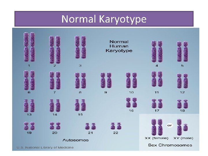 Normal Karyotype 