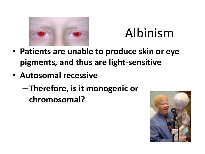 Albinism • Patients are unable to produce skin or eye pigments, and thus are