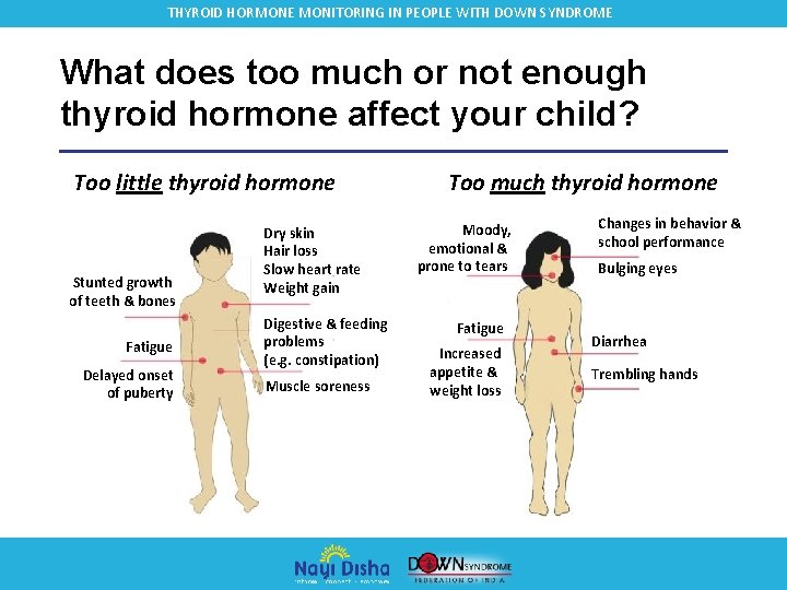 THYROID HORMONE MONITORING IN PEOPLE WITH DOWN SYNDROME What does too much or not