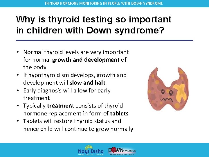 THYROID HORMONE MONITORING IN PEOPLE WITH DOWN SYNDROME Why is thyroid testing so important