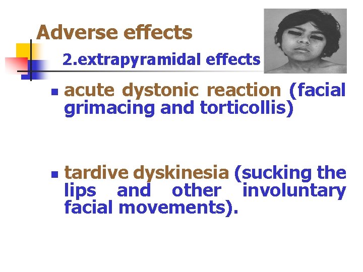 Adverse effects 2. extrapyramidal effects n n acute dystonic reaction (facial grimacing and torticollis)