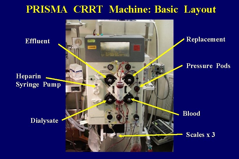 PRISMA CRRT Machine: Basic Layout Effluent Replacement Pressure Pods Heparin Syringe Pump Dialysate Blood