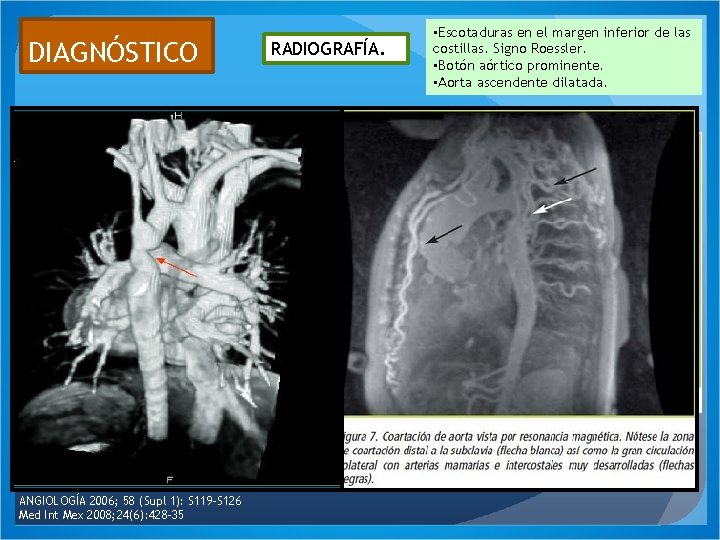 DIAGNÓSTICO ANGIOLOGÍA 2006; 58 (Supl 1): S 119 -S 126 Med Int Mex 2008;