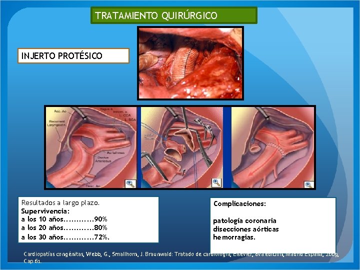 TRATAMIENTO QUIRÚRGICO INJERTO PROTÉSICO Resultados a largo plazo. Supervivencia: a los 10 años. .