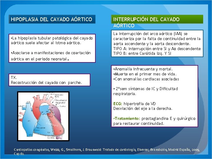 HIPOPLASIA DEL CAYADO AÓRTICO • La hipoplasia tubular patológica del cayado aórtico suele afectar