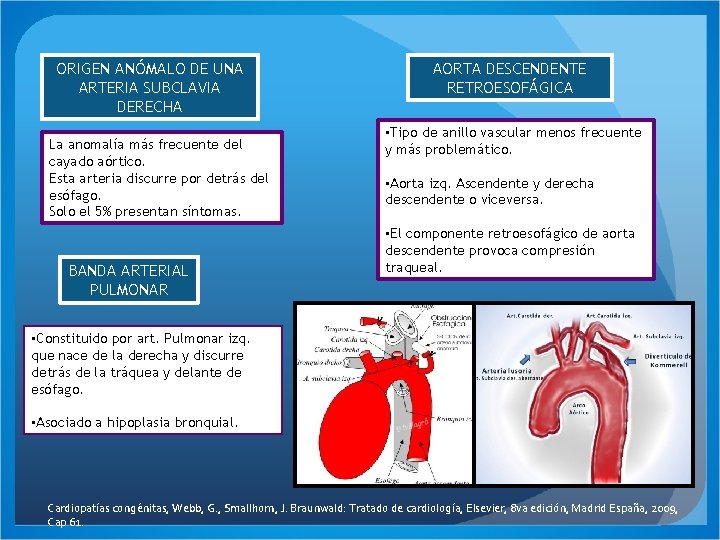 ORIGEN ANÓMALO DE UNA ARTERIA SUBCLAVIA DERECHA La anomalía más frecuente del cayado aórtico.