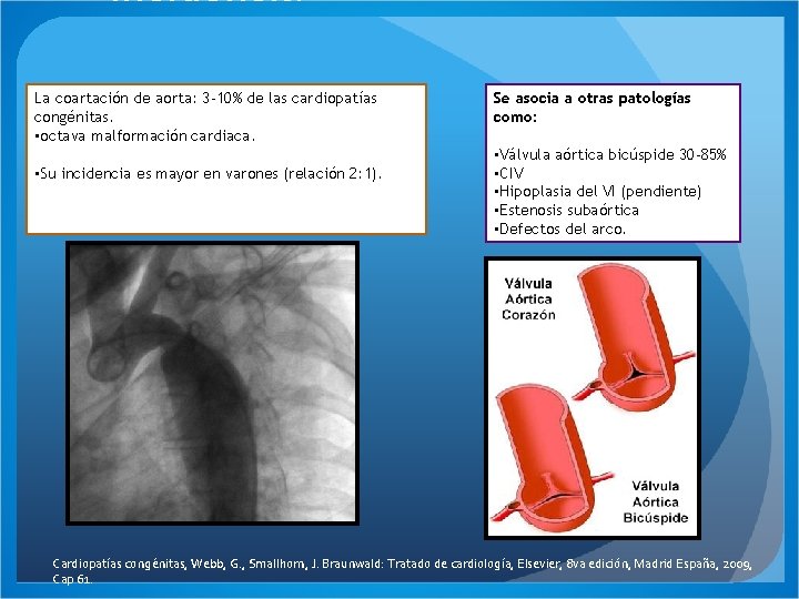 Incidencia La coartación de aorta: 3 -10% de las cardiopatías congénitas. • octava malformación