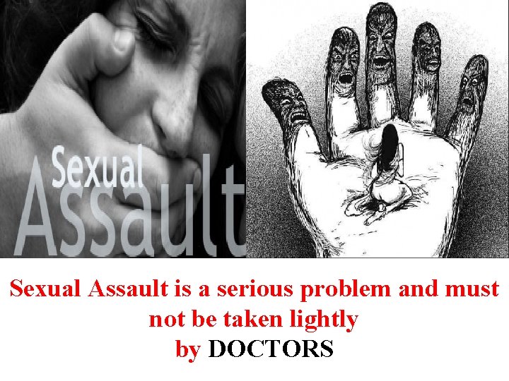 Sexual Assault is a serious problem and must not be taken lightly by DOCTORS