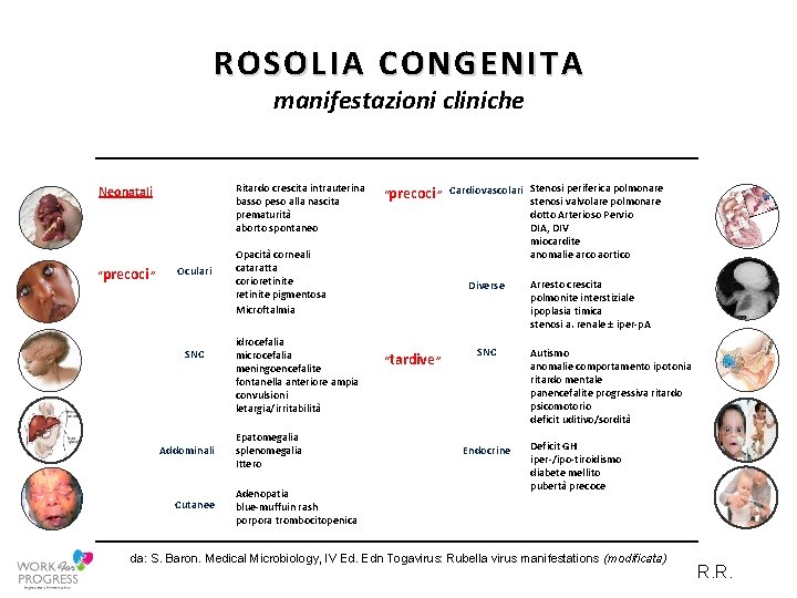 ROSOLIA CONGENITA manifestazioni cliniche Neonatali “precoci” Oculari SNC Addominali Cutanee Ritardo crescita intrauterina basso