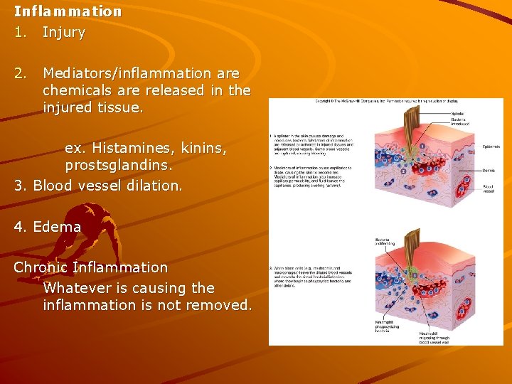 Inflammation 1. Injury 2. Mediators/inflammation are chemicals are released in the injured tissue. ex.